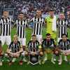 Problema grave per il Newcastle a una settimana dal Milan: Pope è ko