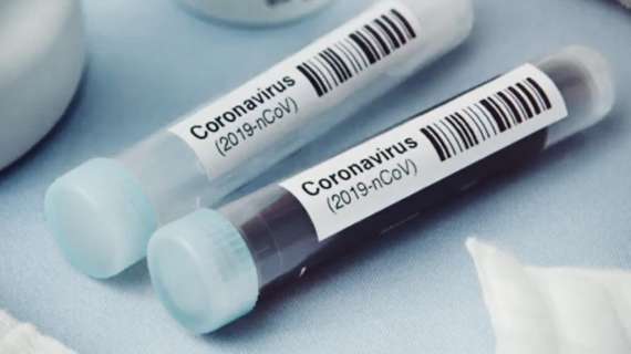 Emergenza Coronavirus, in Sicilia accordo Regione e Federfarma per gli esami nelle farmacie